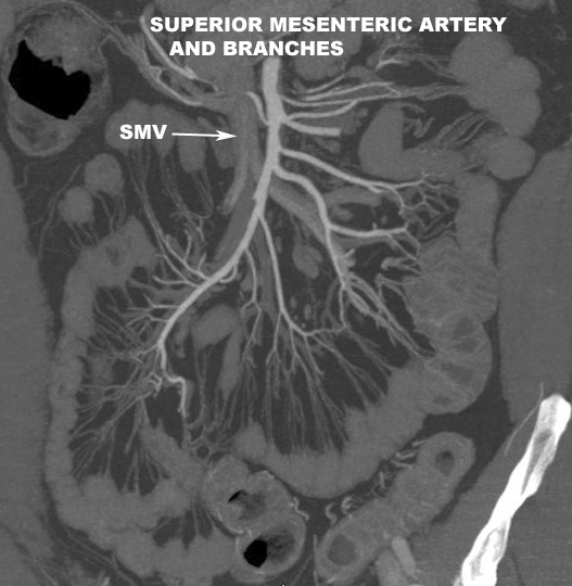 PA view Reconstructed image Branches of SMA
