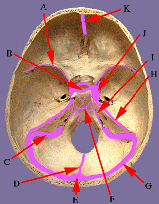 Sinus hollow space exposed