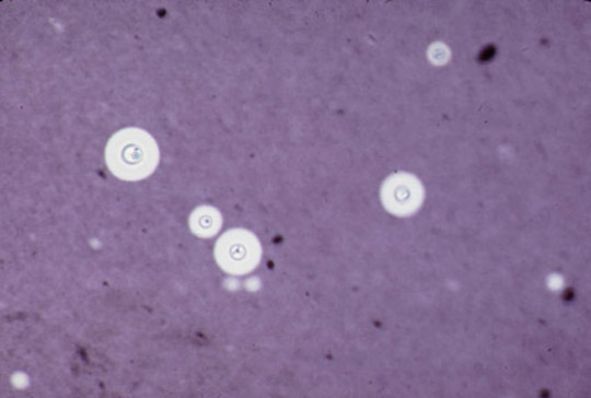 Image: India Ink Stain (Cryptococcus neoformans) - Merck Manuals  Professional Edition