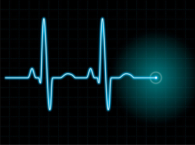 ekg.jpg