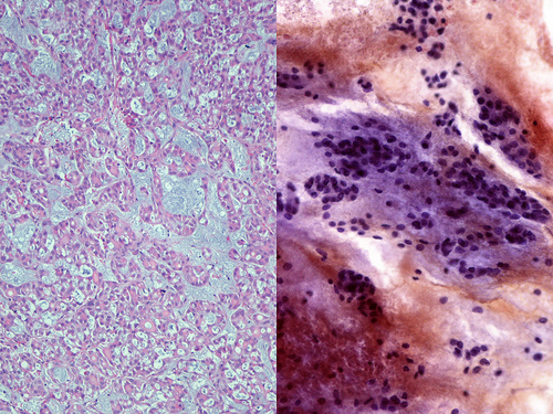 follicular.jpg